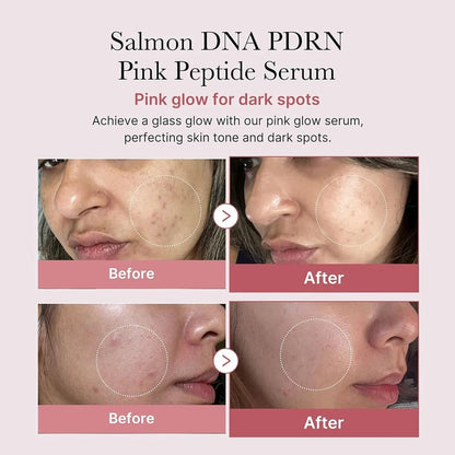 https://i0.wp.com/verinzabeauty.com/wp-content/uploads/2025/10/Medicube-PDRN-Pink-Peptide-Serum-30ml-XOXO-Beauty-1052.jpg?fit=1080%2C1080&ssl=1
